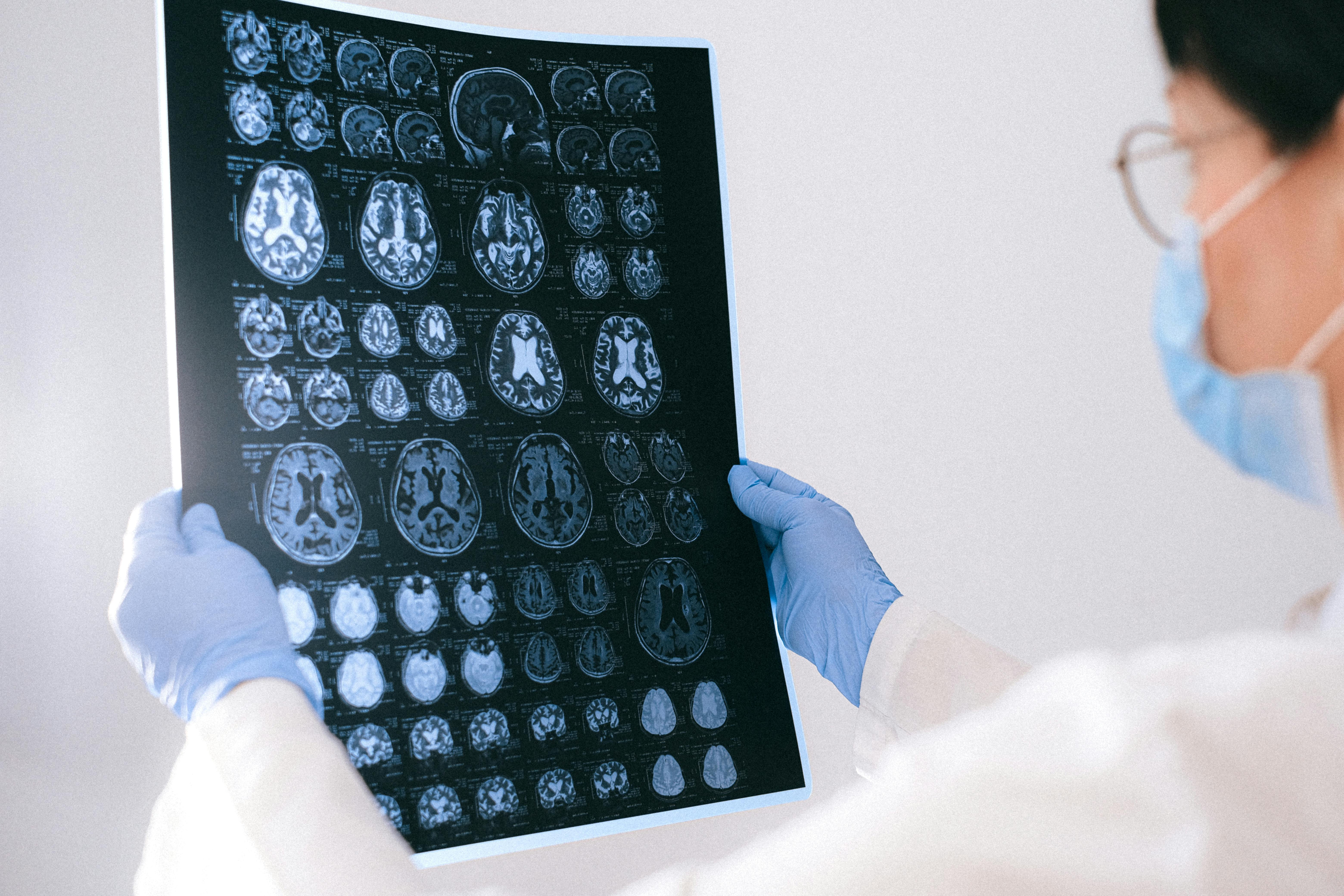 A Doctor Holding an MRI Result of the Brain
